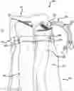 Fig. 01 - Hair Carrying Device