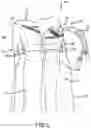 Fig. 06 - Hair Carrying Device