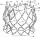 Fig. 01 - FRAME WITH VARIED STRUT WIDTHS FOR PROSTHETIC IMPLANT