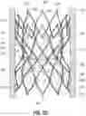 Fig. 28 - FRAME WITH VARIED STRUT WIDTHS FOR PROSTHETIC IMPLANT