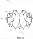 Fig. 40 - FRAME WITH VARIED STRUT WIDTHS FOR PROSTHETIC IMPLANT