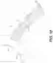 Fig. 09 - HYBRID STENT