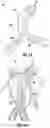 Fig. 02 - DEVICES AND METHODS FOR STENT GRAFT EXTRACTION
