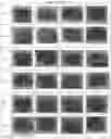 Fig. 07 - Synergistic bioactive compositions for treating neurological disorders