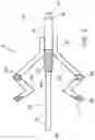 Fig. 03 - ISOLATION AND ATTACHMENT CATHETERS AND METHODS FOR USING THEM