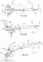 Fig. 07 - ISOLATION AND ATTACHMENT CATHETERS AND METHODS FOR USING THEM