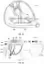 Fig. 15 - Golf club heads