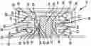 Fig. 01 - FASTENER AND ARRANGEMENT COMPRISING A FASTENER