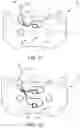 Fig. 09 - Method and system for detecting and measuring a braking force of a braking system for vehicle, by means of photonic sensors incorporated in a brake pad
