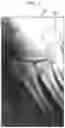 Fig. 03 - System and method for identifying fractures in digitized x-rays