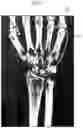 Fig. 08 - System and method for identifying fractures in digitized x-rays