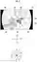 Fig. 07 - Endoscope having a treatment tool outlet port