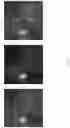 Fig. 08 - Processing of multimodal retinal images