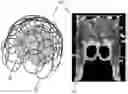 Fig. 01 - TERRITORY MAPPING IN PSEUDO-CONTINUOUS ARTERIAL SPIN LABELING