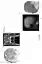 Fig. 02 - TERRITORY MAPPING IN PSEUDO-CONTINUOUS ARTERIAL SPIN LABELING