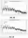 Fig. 05 - METHOD AND SYSTEM TO ASSESS DISEASE USING DYNAMICAL ANALYSIS OF CARDIAC AND PHOTOPLETHYSMOGRAPHIC SIGNALS