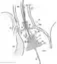 Fig. 01 - Method for delivery of prosthetic aortic valve