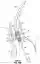 Fig. 45 - Method for delivery of prosthetic aortic valve
