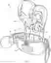 Fig. 01 - TLSO/LSO spine brace