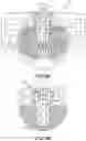 Fig. 04 - TLSO/LSO spine brace