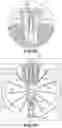 Fig. 05 - TLSO/LSO spine brace