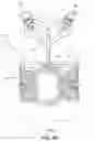 Fig. 09 - TLSO/LSO spine brace