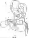Fig. 11 - TLSO/LSO spine brace