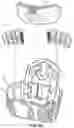 Fig. 15 - TLSO/LSO spine brace