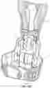 Fig. 24 - TLSO/LSO spine brace