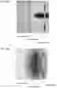 Fig. 10 - OCULAR DELIVERY OF THERAPEUTIC AGENTS