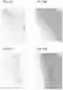 Fig. 26 - OCULAR DELIVERY OF THERAPEUTIC AGENTS