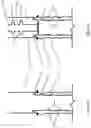 Fig. 02 - Plug and abandon operation in a hydrocarbon well by cementing the annulus through apertures in the casing