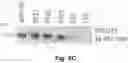 Fig. 15 - Method and reagents for the detection of an autoantibody