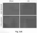 Fig. 19 - Method and reagents for the detection of an autoantibody