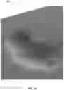 Fig. 09 - Systems and methods for interactively extrapolating breaklines over surfaces