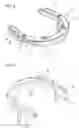 Fig. 04 - Closure device having closure parts which are able to be placed against one another