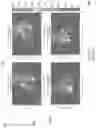 Fig. 02 - Visualizing scattered radiation in a medical facility