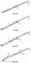 Fig. 08 - IMPLANTABLE REPAIR DEVICES