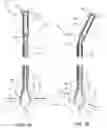 Fig. 09 - INTRAVASCULAR ARTICULATING RETRIEVAL APPARATUS