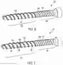Fig. 05 - BONE SCREW