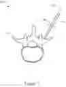 Fig. 08 - Systems and methods for spinal surgical procedures