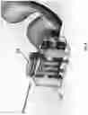 Fig. 16 - SYSTEMS AND METHODS FOR ROBOTIC BRONCHOSCOPY