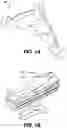 Fig. 02 - Gross positioning device and related systems and methods