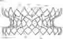 Fig. 01 - Frame Features for Transcatheter Mitral Valve Replacement Device