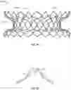 Fig. 08 - Frame Features for Transcatheter Mitral Valve Replacement Device