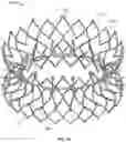 Fig. 22 - Frame Features for Transcatheter Mitral Valve Replacement Device