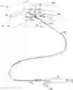 Fig. 01 - CERVICAL DISTRACTION METHOD