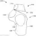 Fig. 01 - SYSTEMS AND METHODS FOR CONTROLLED FACET REPOSITIONING IN THE CALCANEUS