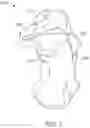 Fig. 02 - SYSTEMS AND METHODS FOR CONTROLLED FACET REPOSITIONING IN THE CALCANEUS