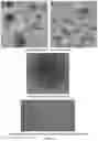 Fig. 05 - Emulsions for local anesthetics